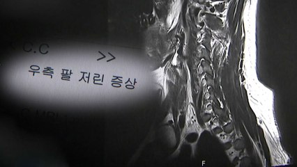 [단독] 엉뚱한 사람 MRI로 치료..."건강하니 책임 없다" / YTN