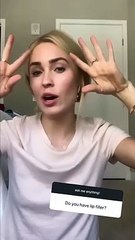 Bachelor Contestant Cassie Randolph Says She Gets Lip Filler And Botox