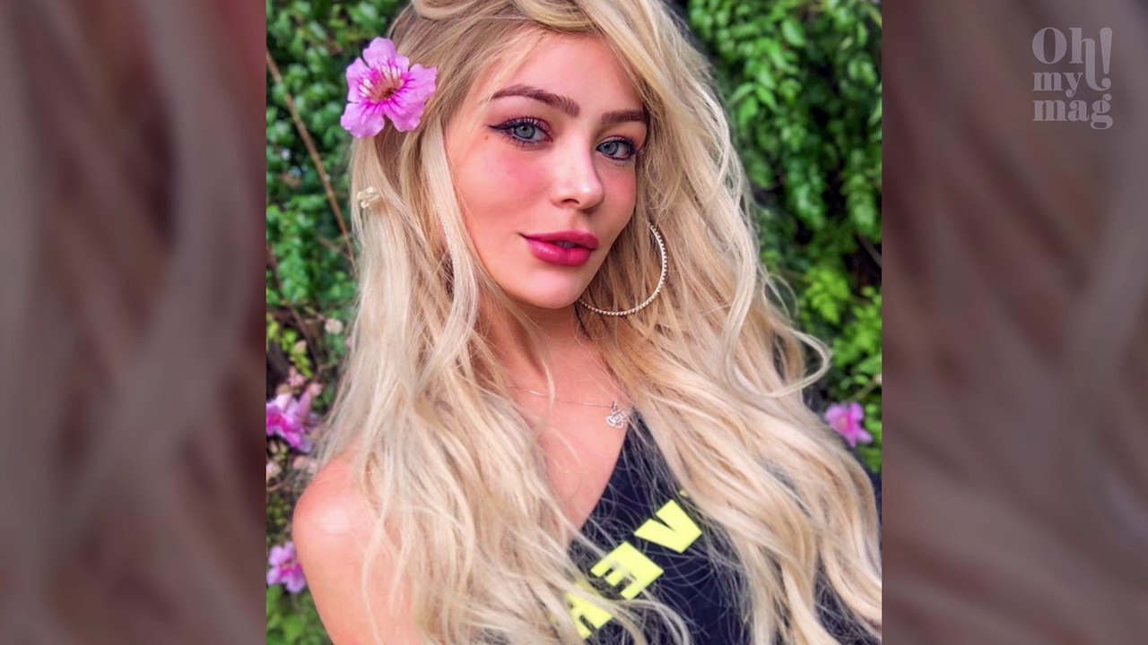 Youtuber e modelo é vítima de paralisia facial e desabafa na web