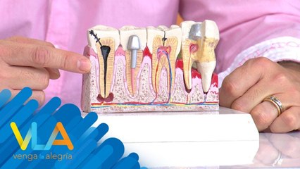 ¿En qué momentos se puede presentar la gingivitis? | Venga La Alegría