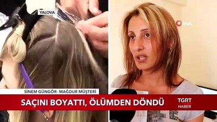 Saçını Boyattı, Ölümden Döndü