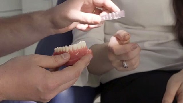 Se presenta un nuevo sistema de alineadores dentales más cómodo y flexible