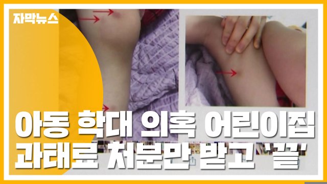 [자막뉴스] CCTV 고장 ...학대 의혹 어린이집 과태료만 / YTN