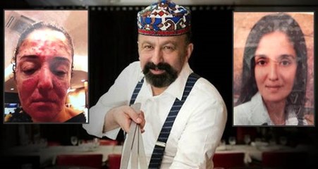 'Ünlü iş adamı yüzüme kimyasal attı' iddiası yalan çıktı