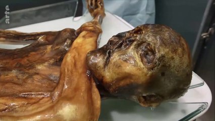 Ötzi, La Renaissance De l'Homme Des Glaces