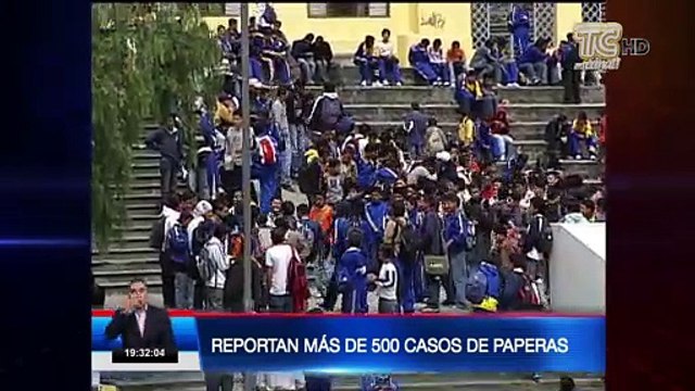 Reportan más de 500 casos de paperas en Quito