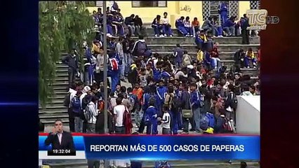 Reportan más de 500 casos de paperas en Quito