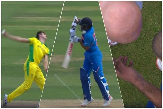 Shikhar Dhawan Ruled Out Of The World Cup For Three Weeks | Oneindia Malayalam