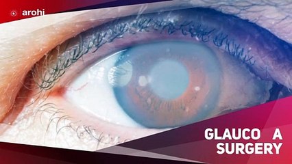 Arohi Eye Hospital - Best Eye Care Specialist Hospital in Oshiwara, Andheri West Mumbai