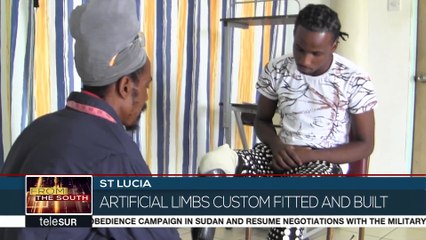 St Lucia: Amputees Program