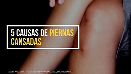 5 causas de piernas cansadas
