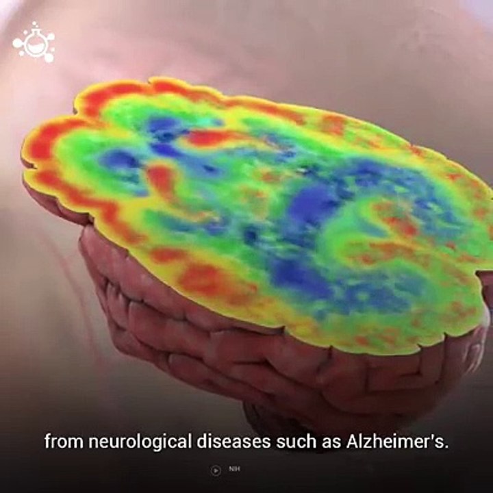 How does the Brain Work