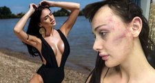 Sırp model Tanja Djukic, Türk sevgilisinden dayak yediğini iddia ederek şikayetçi oldu