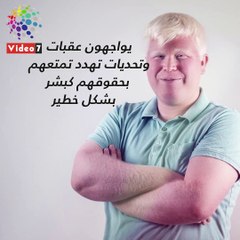 فيديو جراف.. "الألبينو" ضحايا الخرافات والسحر الأسود