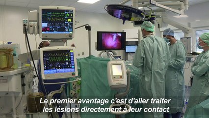 Cancer: la chimiothérapie par aérosol, l'espoir pour les malades