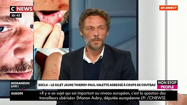 EXCLU - Agressé à coups de couteau, le gilet jaune Thierry-Paul Valette annonce qu'il va porter plainte aujourd'hui - VIDEO