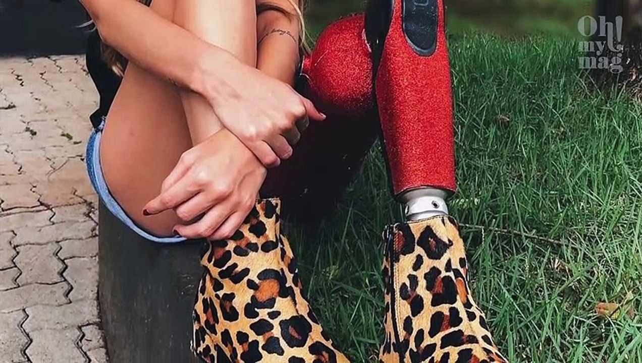 Modelo que teve perna amputada faz enorme sucesso no Instagram