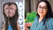 Chhapaak: WHY Deepika Padukone was first choice to play Laxmi, Reveals Meghna Gulzar |FilmiBeat