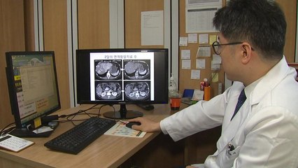 암치료의 새로운 표준 '면역항암치료'...병합치료로 효과 높인다 / YTN