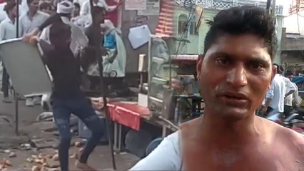 समोसा का 1 रुपए नहीं दिया तो दुकानदार ने युवक के ऊपर डाल दिया खौलता तेल, Video