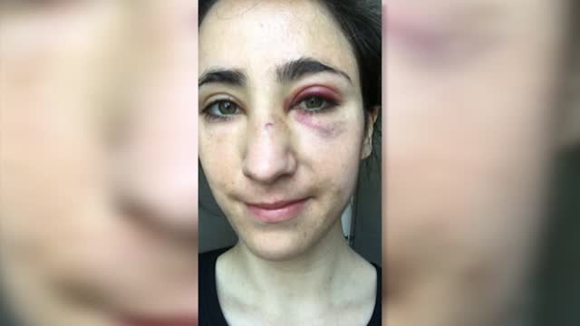 Una pareja de chicas sufre un ataque homófobo en Londres tras intentar ser obligadas a besarse