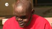 Nuevo 'milagro' del doctor Cavadas: reconstruye el rostro y la mano de un keniano atacado por una hiena