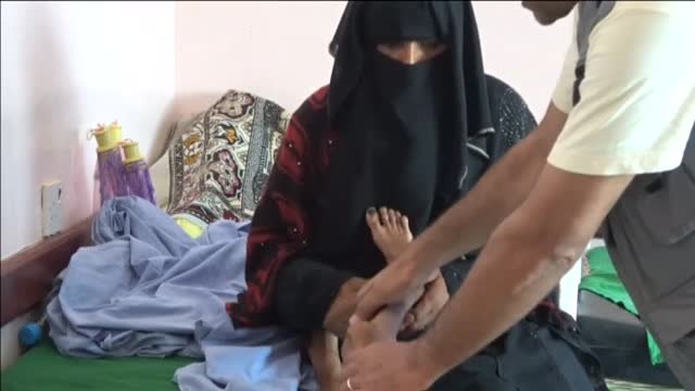 Dramática historia de una adolescente yemení que apenas pesa 10 kilos y que podría morir