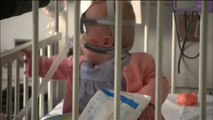 Vanellope es el primer bebé en Reino Unido que sobrevive después de nacer con el corazón fuera del pecho
