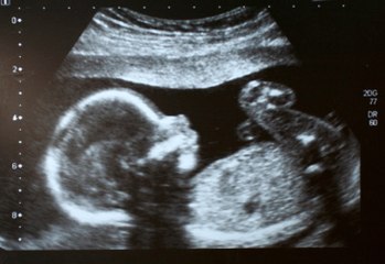 Cette nouvelle technique d’IRM permet d’obtenir les images de grossesse les plus détaillées jamais enregistrées