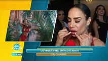 Lis Vega confesó que se inyectó colágeno en sus labios. | Venga La Alegría