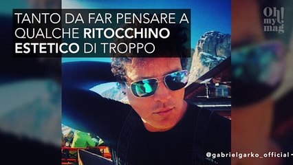 Gabriel Garko spiegal la sua faccia gonfia