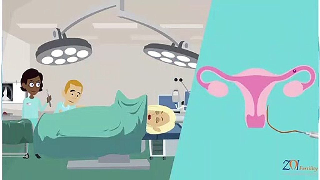 Zoi Fertility - Sequential Embryo Transfer