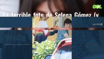 La terrible foto de Selena Gómez (y tiene horas) al salir del dermatólogo: “¿Qué le pasa en la cara?”
