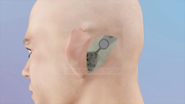 Zvarritje prej dy vitesh të blerjes së pajisjeve për fëmijët, një tender pengon dëgjimin