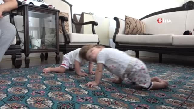 Kafadan yapışık siyam ikizleri 1 yaşında