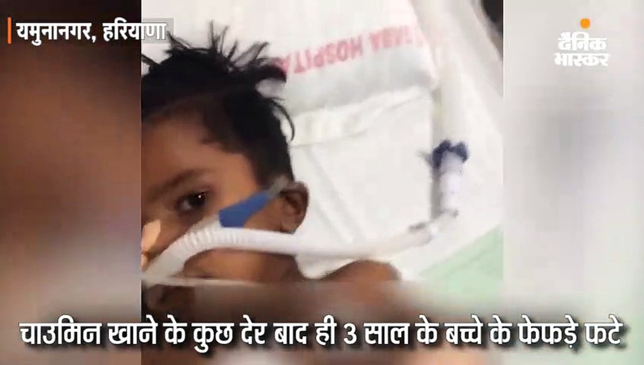 चाउमीन खाने के बाद 3 साल के बच्चे के फेफड़े फटे