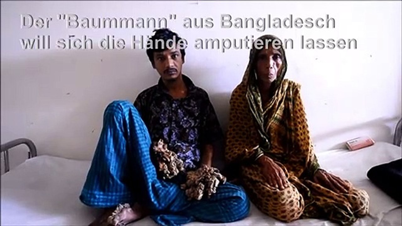 "baummann" will sich hände amputieren lassen