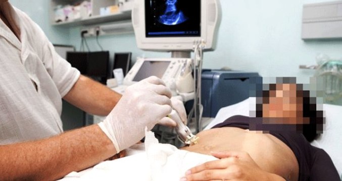 Hastalarını kendi spermiyle gebe bırakan kadın doğum doktoru meslekten men edildi