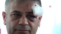 İYİ Parti grup başkan vekili trafikte 4 kişinin saldırısına uğradı