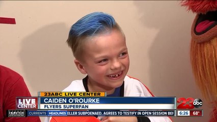 Mascot surprises fan with prosthetic legs