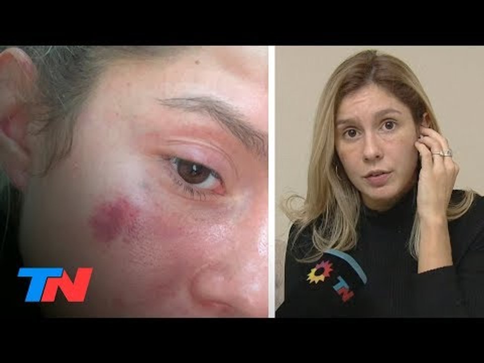 Denunció las golpizas de su exnovio: "Estaba dispuesto a matarme"