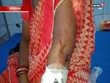 पारिवारिक विवाद में ननद ने भाभी पर चाकू से किया हमला  हमला, गंभीर हालत में अस्पताल में भर्ती