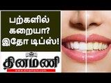 உங்கள் பற்கள் மஞ்சள் நிறத்தில் உள்ளதா? | Removal of Yellow Teeth Stains | teeth whitening in tamil