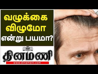 Download Video: Hair fall Treatment  |  BIGGEST HAIR Fall AND BALDNESS MYTHS REVEALED