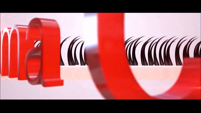 Budding Kollywood Actor Hair Transplant Results in Chennai Tamil Nadu - DermaClinix