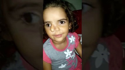 3 yaşındaki minik Öykü, ameliyat için yardım bekliyor