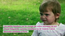 Bébé a des petits boutons : c'est grave ?