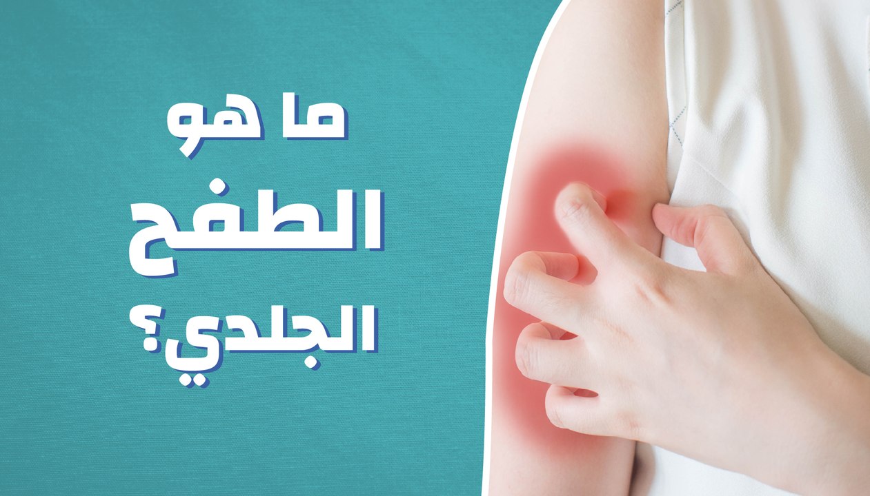 ما هو الطفح جلدي؟