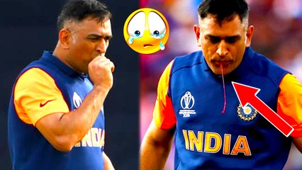 WORLD CUP 2019 Dhoni with blood | விரலில் ஏற்பட்ட காயம். வைரலாகும் அந்த ஒரு புகைப்படம்!