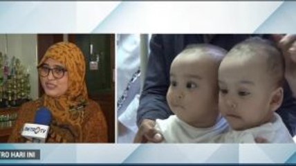 Bayi Kembar Siam asal Tapanuli Utara akan Jalani Operasi Pemisahan